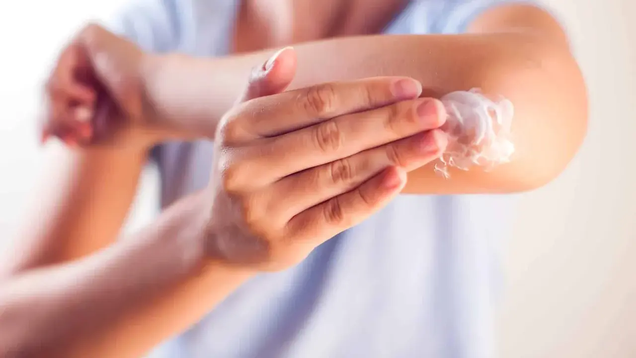 Application d'une crème apaisante sur le coude, une solution pour l'eczéma traitement naturel.