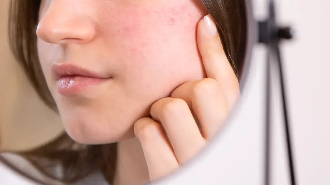 Une jeune femme examine son visage rouge, peut-être à cause de l'alcool, dans un miroir.