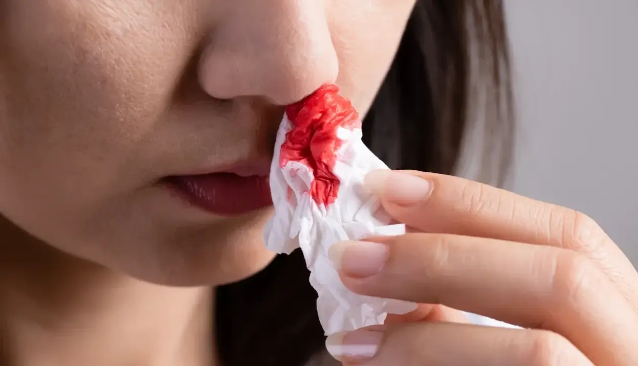 Une personne utilise un mouchoir pour éponger le sang des ailes du nez rouge.