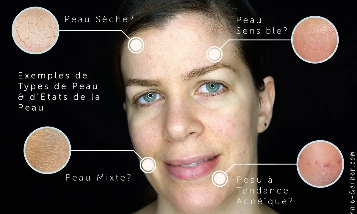 Identifier les types de peau : sèche, sensible, mixte, acnéique. Comment savoir si on a la peau grasse ? L'image montre des exemples visuels.