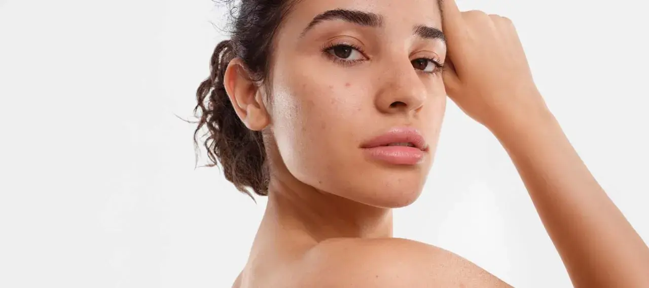 Visage d'une jeune femme avec quelques imperfections, illustrant ce qu'est la peau mixte.