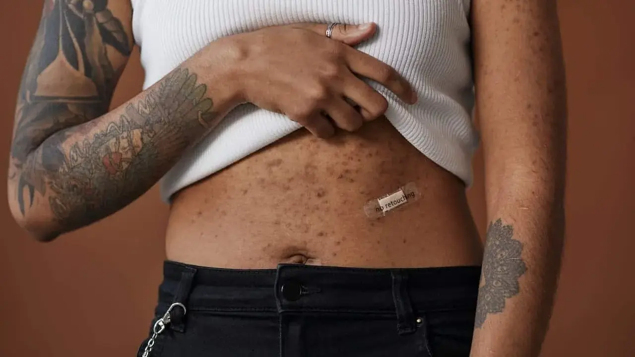 Une femme montre sa peau après accouchement, marquée par des taches et des tatouages. Un pansement "no retouching" sur son ventre célèbre l'authenticité.