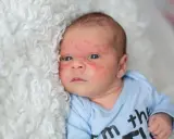 Visage de bébé avec un bouton de lait, sur une couverture blanche et moelleuse.