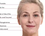 Visage d'une femme montrant les rides du visage signification : frontales, du lion, patte d'oie, canal lacrymal, nasogéniennes, plis d'amertume, sillon labio-mental.