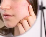 Une jeune femme examine son visage rouge, peut-être à cause de l'alcool, dans un miroir.