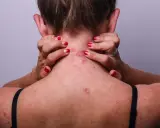 Une personne se gratte le cou et l'épaule, révélant des rougeurs et des irritations dues à l'eczéma.