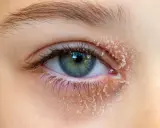 Œil avec peau sèche et squameuse autour, symptôme d'un eczéma paupière.
