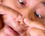 Doigts pinçant un gros bouton noir sur la peau du nez, gros plan sur le visage.