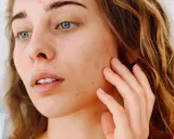 Jeune femme examinant son visage dans un miroir, avec des rougeurs et des imperfections. Comment savoir notre type de peau pour mieux en prendre soin.