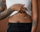 Une femme montre sa peau après accouchement, marquée par des taches et des tatouages. Un pansement "no retouching" sur son ventre célèbre l'authenticité.