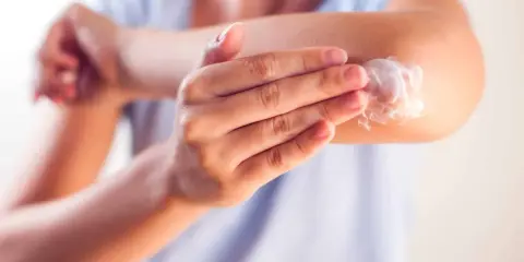 Application d'une crème apaisante sur le coude, une solution pour l'eczéma traitement naturel.