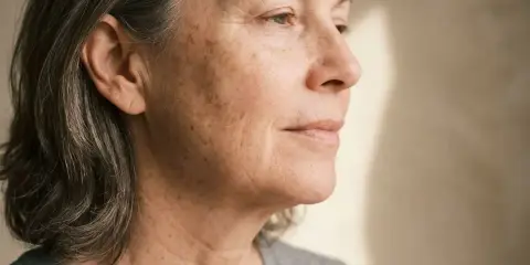 Portrait d'une femme mûre avec des taches brunes sur le visage. Découvrez comment enlever les taches sur le visage en 3 jours pour une peau plus uniforme.