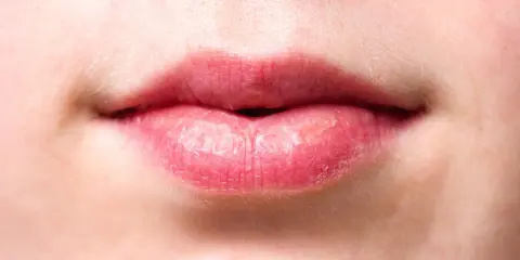 Gros plan sur des lèvres gercées qui ne guérissent pas, la peau semble sèche et craquelée.