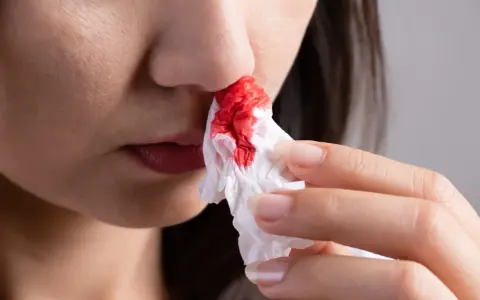 Une personne utilise un mouchoir pour éponger le sang des ailes du nez rouge.