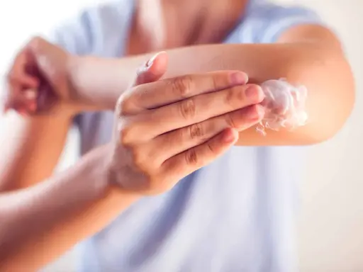 Application d'une crème apaisante sur le coude, une solution pour l'eczéma traitement naturel.