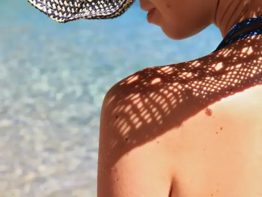 Ombre d'un chapeau sur une épaule bronzée, avec un grain de beauté soleil bien visible. L'eau bleue et claire de la mer scintille en arrière-plan.