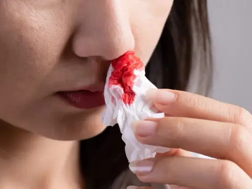 Une personne utilise un mouchoir pour éponger le sang des ailes du nez rouge.