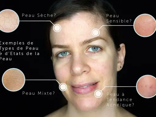 Identifier les types de peau : sèche, sensible, mixte, acnéique. Comment savoir si on a la peau grasse ? L'image montre des exemples visuels.