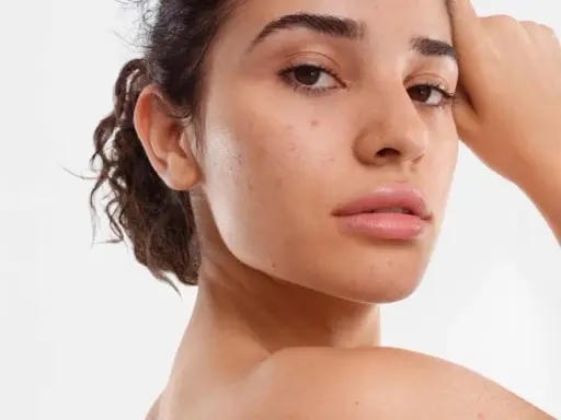 Visage d'une jeune femme avec quelques imperfections, illustrant ce qu'est la peau mixte.