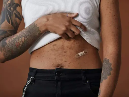 Une femme montre sa peau après accouchement, marquée par des taches et des tatouages. Un pansement "no retouching" sur son ventre célèbre l'authenticité.