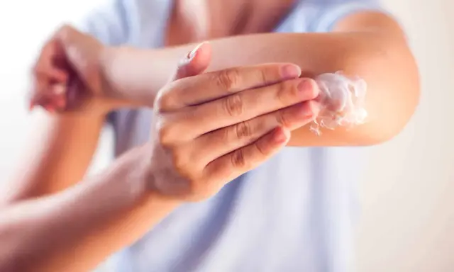 Application d'une crème apaisante sur le coude, une solution pour l'eczéma traitement naturel.