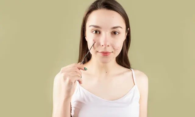 Une jeune femme avec des boutons sur le visage tient un outil pour les extraire. L'acide salicylique peut être un danger s'il est mal utilisé.