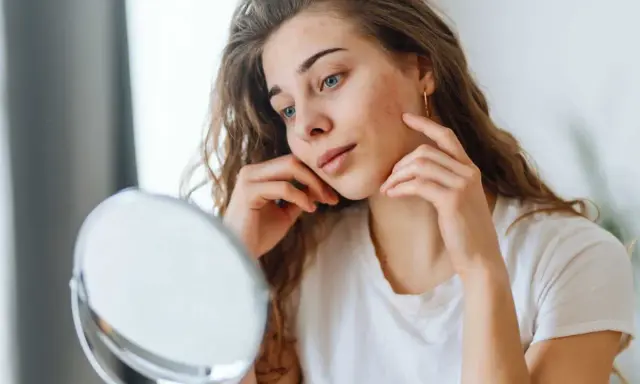 Jeune femme examinant un bouton sur sa joue, se demandant si le dentifrice pourrait aider.
