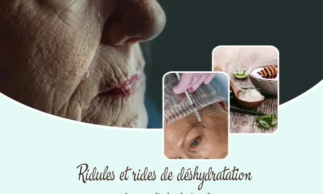 Gros plan sur une peau marquée par des ridules de déshydratation. Une injection et de l'aloe vera suggèrent des solutions.