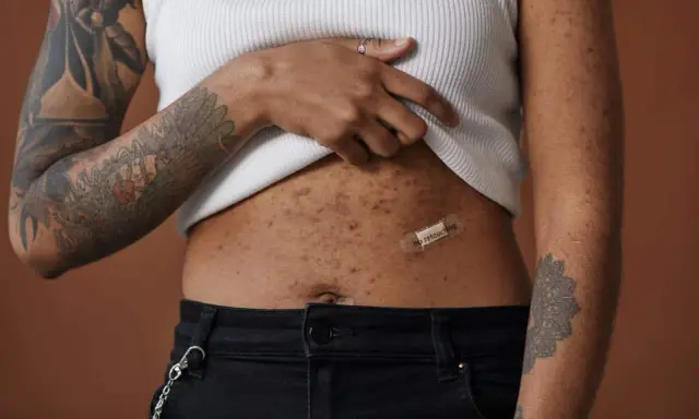 Une femme montre sa peau après accouchement, marquée par des taches et des tatouages. Un pansement "no retouching" sur son ventre célèbre l'authenticité.