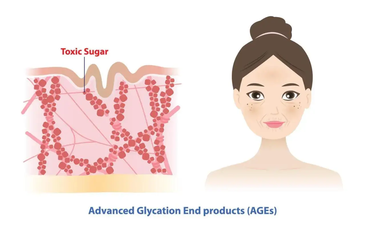 Illustration montrant l'effet du sucre sur la peau : une coupe transversale de la peau avec du