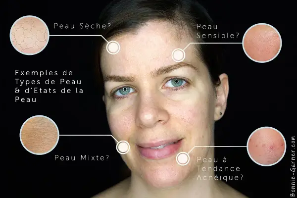 Identifier les types de peau : sèche, sensible, mixte, acnéique. Comment savoir si on a la peau grasse ? L'image montre des exemples visuels.